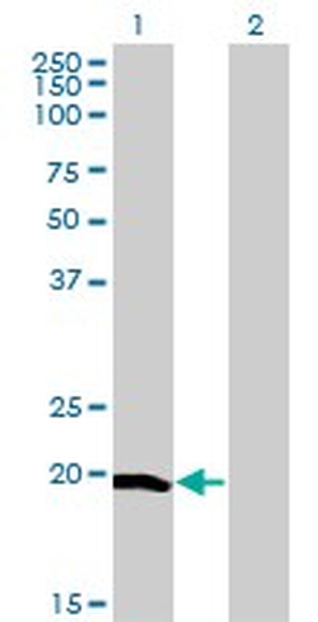 CETN1 Antibody in Western Blot (WB)
