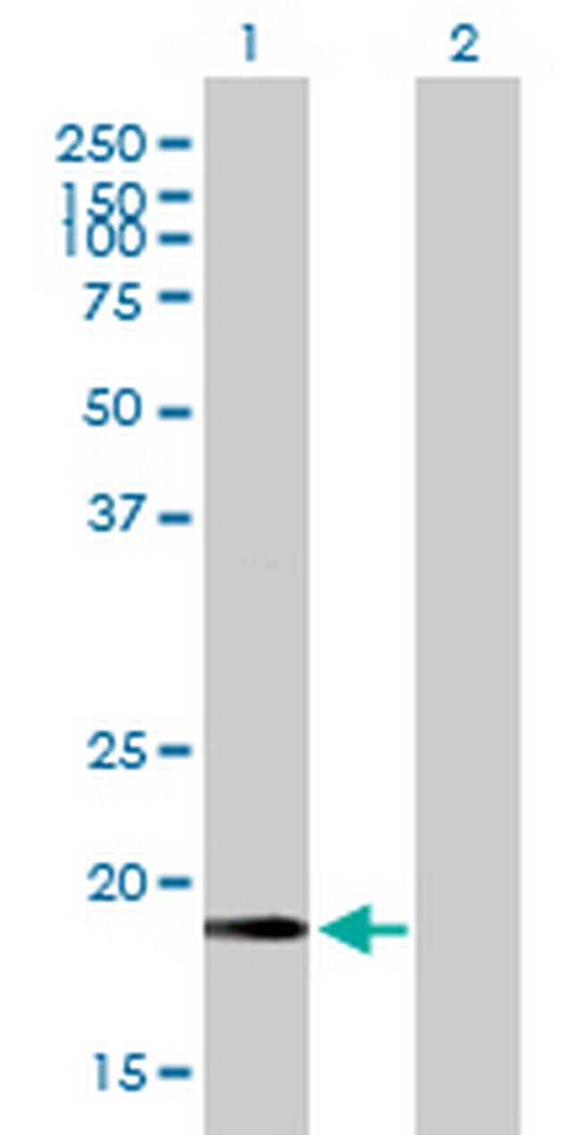 CETN2 Antibody in Western Blot (WB)