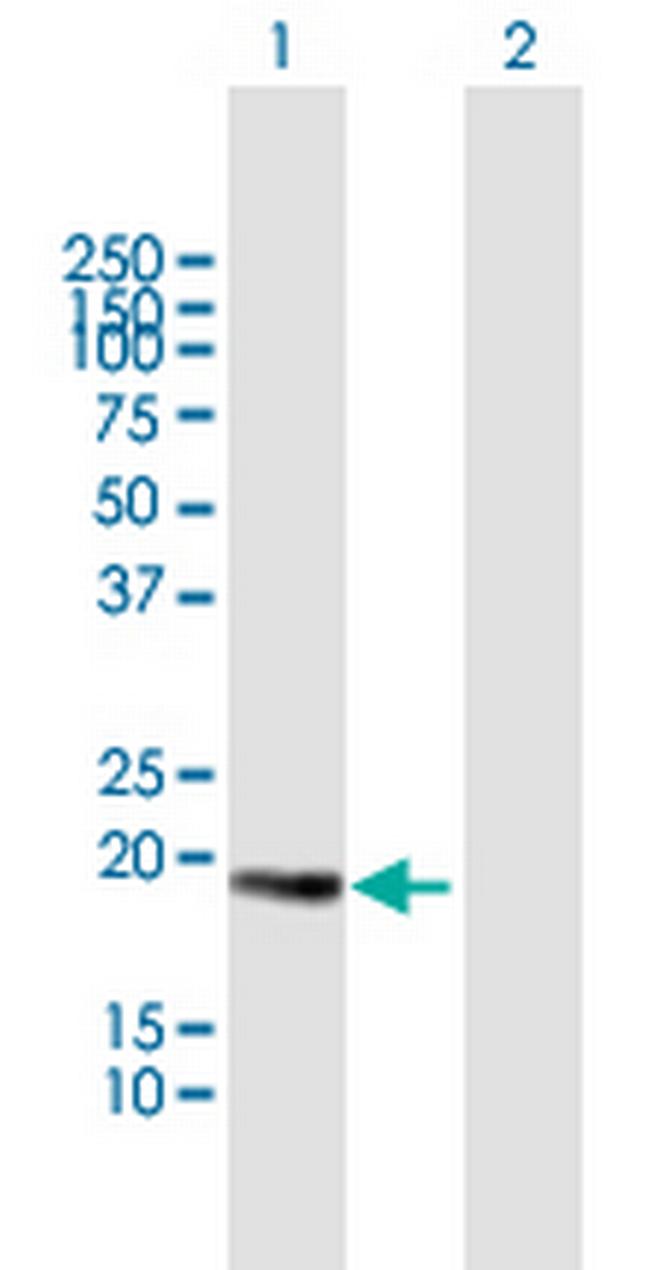 CETN3 Antibody in Western Blot (WB)