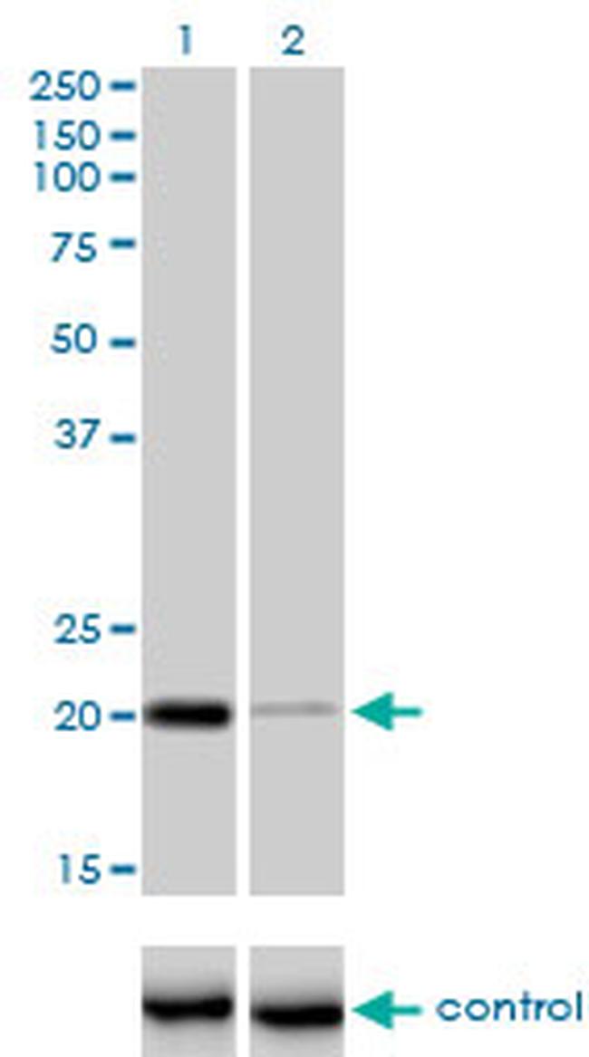 CETN3 Antibody in Western Blot (WB)