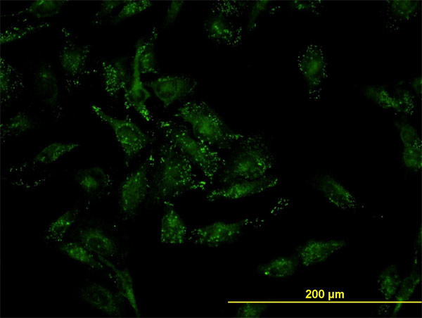 CFL2 Antibody in Immunocytochemistry (ICC/IF)