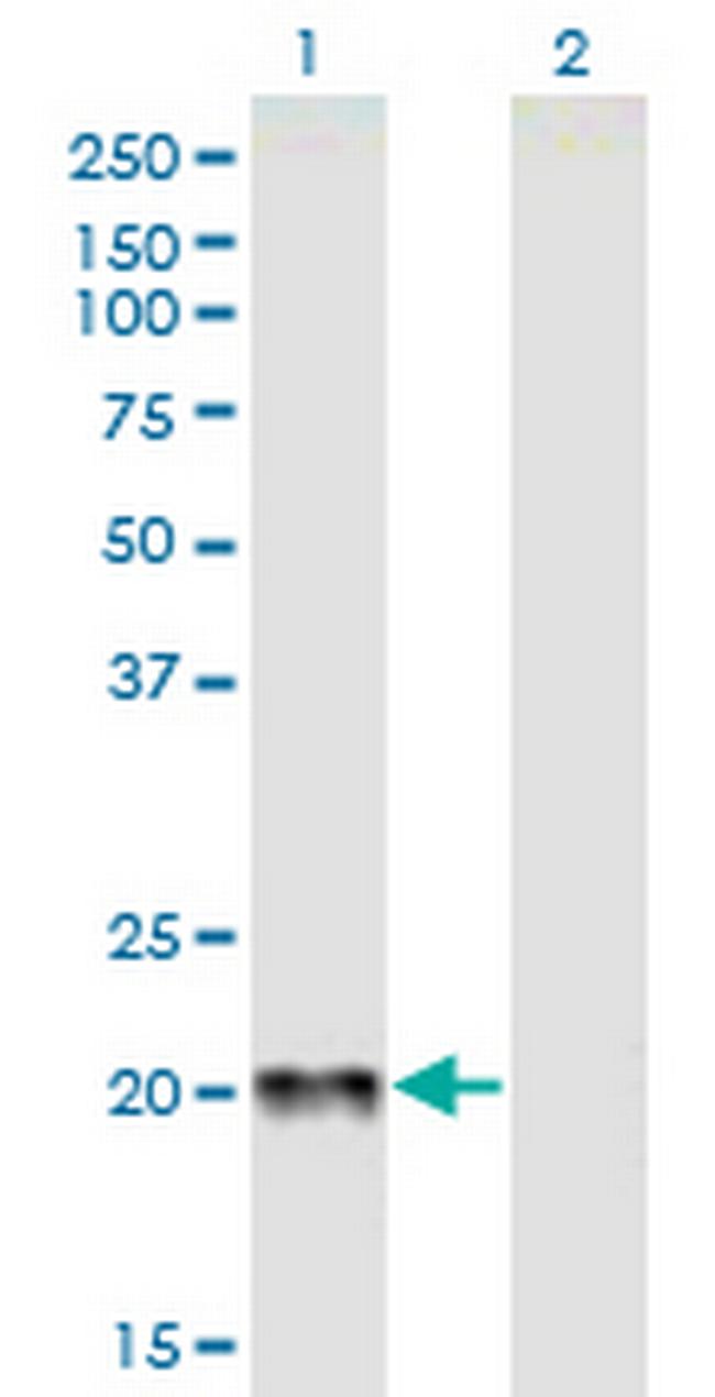 CGB Antibody in Western Blot (WB)