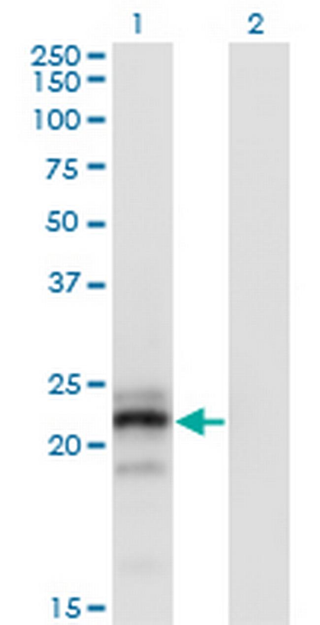 CGB Antibody in Western Blot (WB)