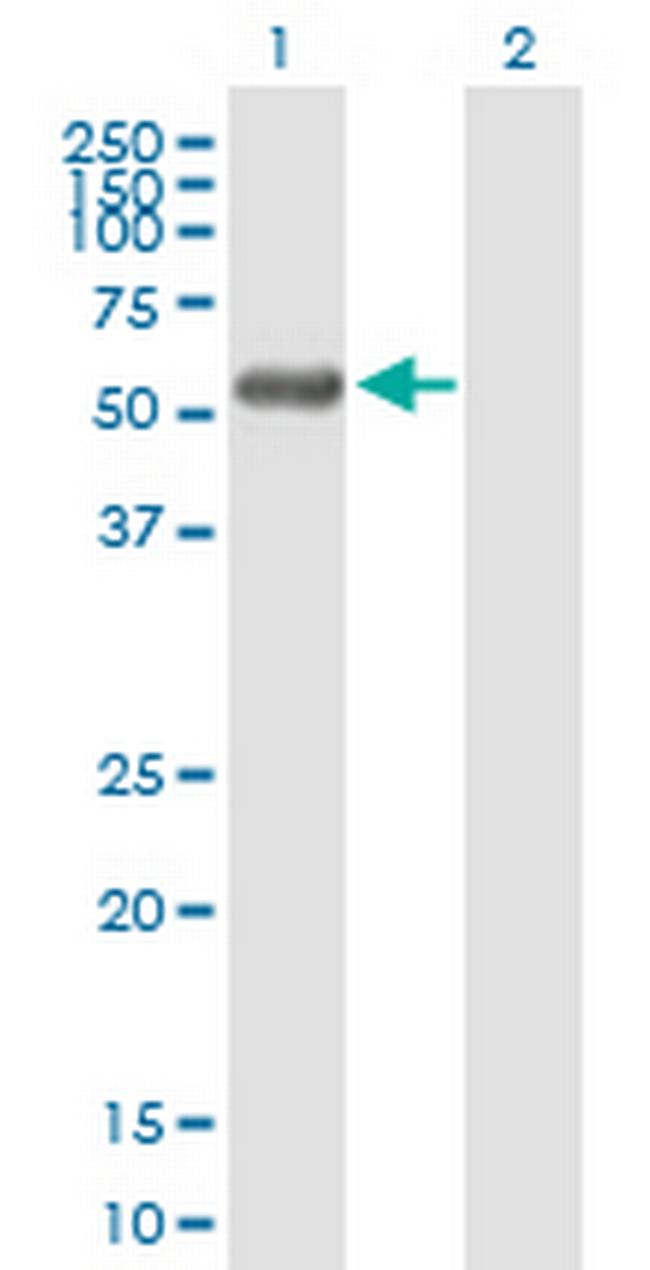 RCBTB2 Antibody in Western Blot (WB)