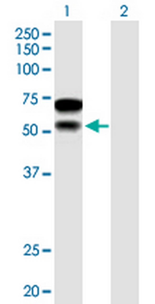 CHD2 Antibody in Western Blot (WB)