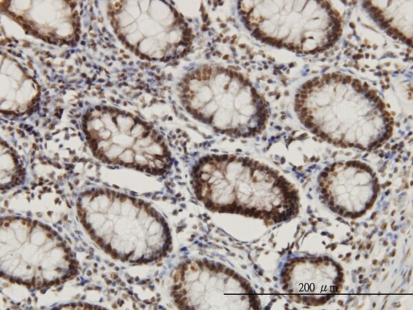 CHD3 Antibody in Immunohistochemistry (Paraffin) (IHC (P))
