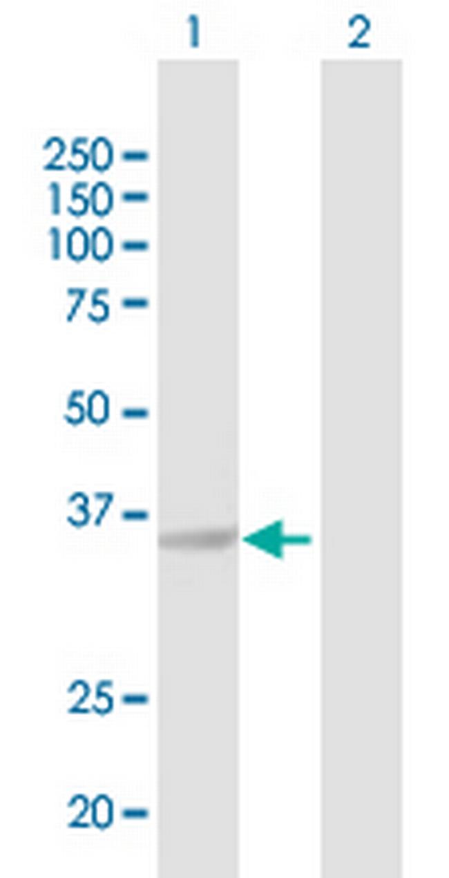AKR1C4 Antibody in Western Blot (WB)