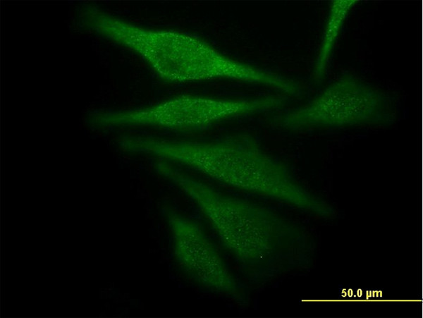 AKR1C4 Antibody in Immunocytochemistry (ICC/IF)