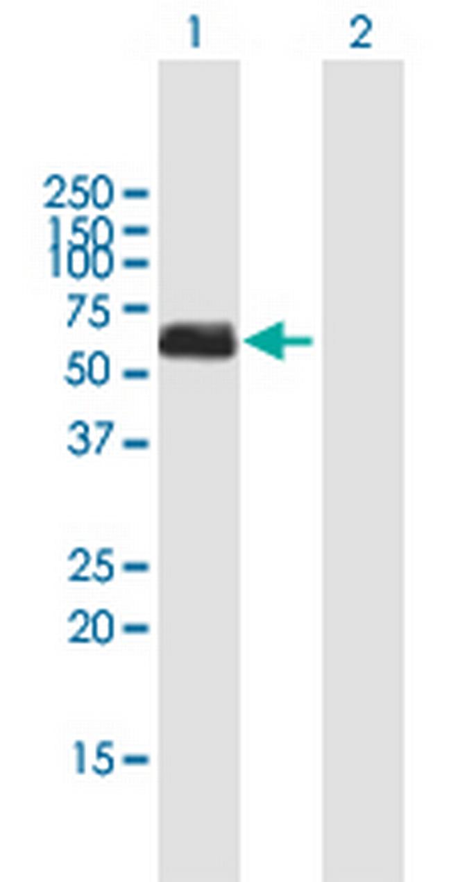 CHEK1 Antibody in Western Blot (WB)