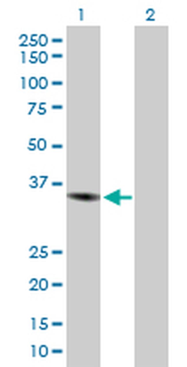 CHI3L1 Antibody in Western Blot (WB)