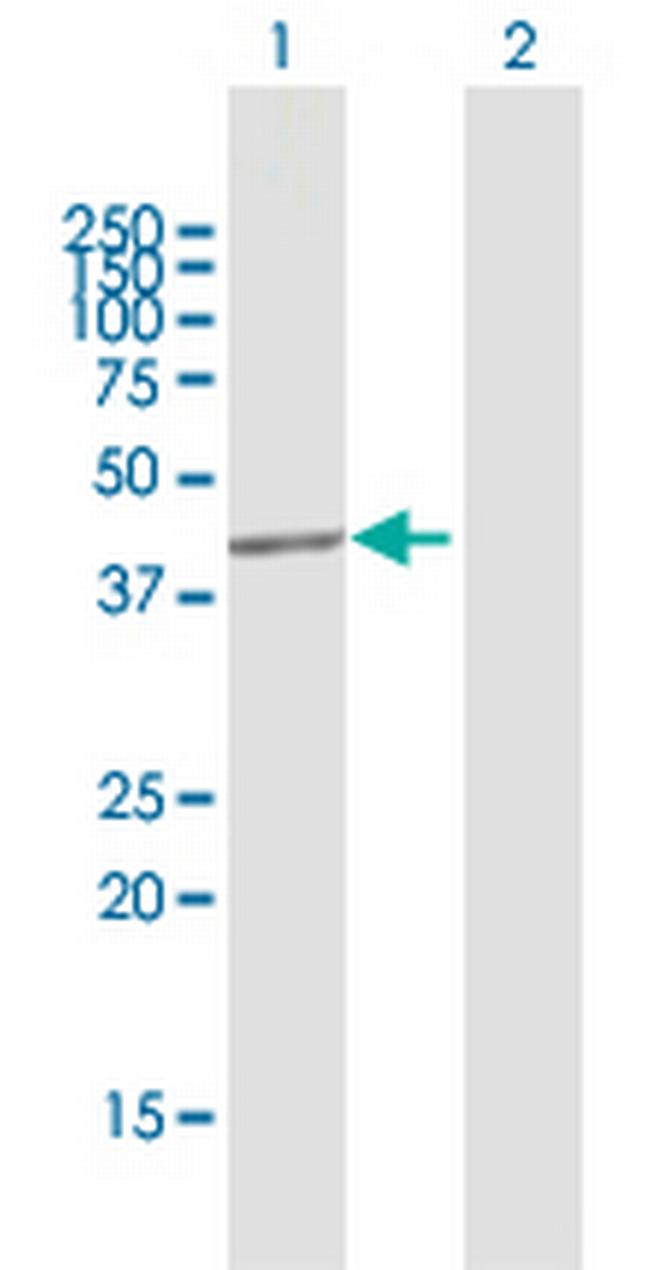 CHKB Antibody in Western Blot (WB)