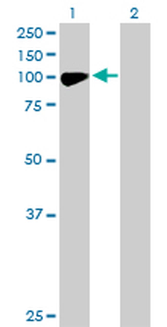CHML Antibody in Western Blot (WB)