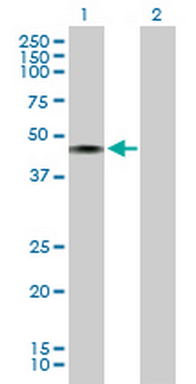 CHN1 Antibody in Western Blot (WB)