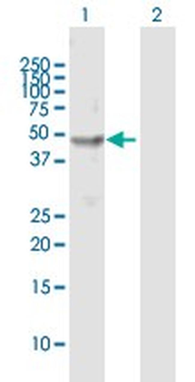CHN1 Antibody in Western Blot (WB)