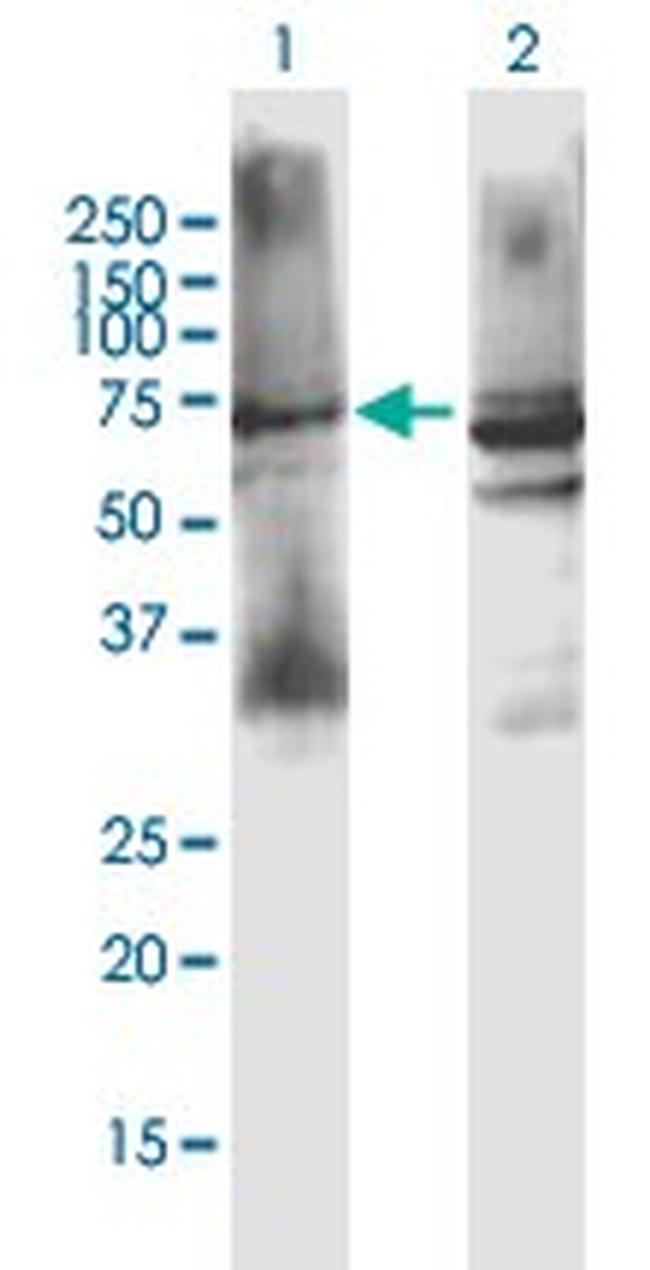 CHRM3 Antibody in Western Blot (WB)