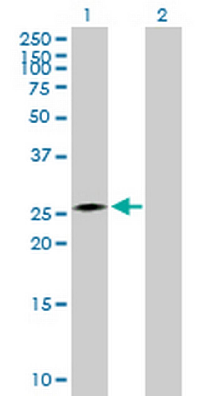 CIDEA Antibody in Western Blot (WB)