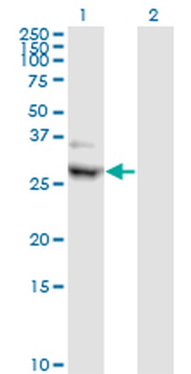 CIDEA Antibody in Western Blot (WB)