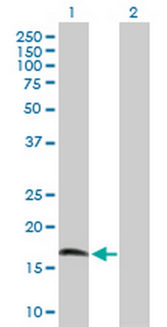 CIRBP Antibody in Western Blot (WB)