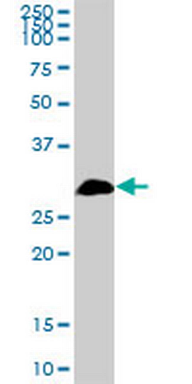TBCB Antibody in Western Blot (WB)