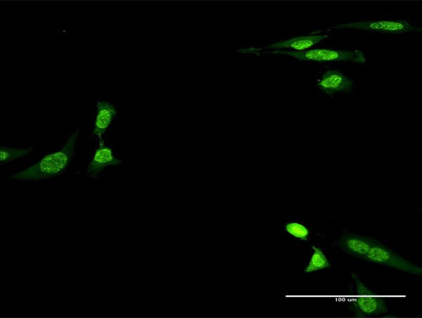 CKM Antibody in Immunocytochemistry (ICC/IF)