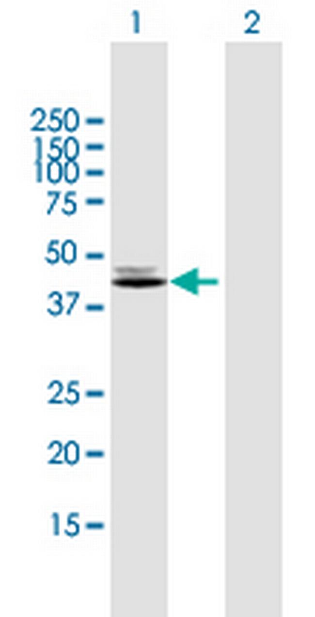 CKMT2 Antibody in Western Blot (WB)