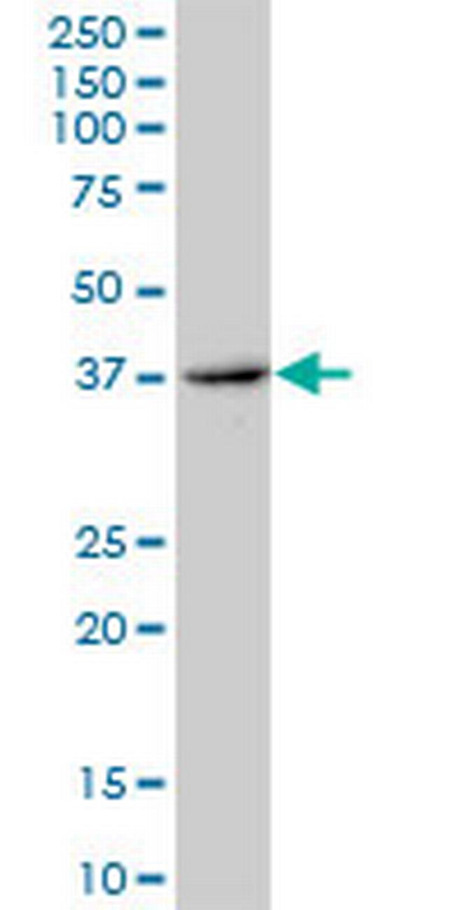 ERCC8 Antibody in Western Blot (WB)