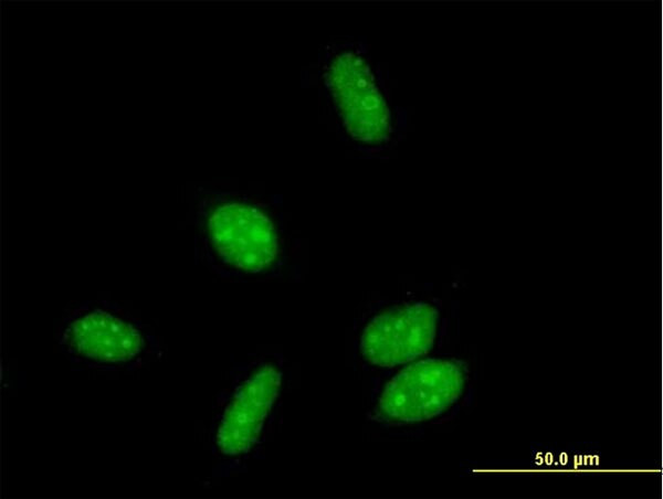 ERCC8 Antibody in Immunocytochemistry (ICC/IF)