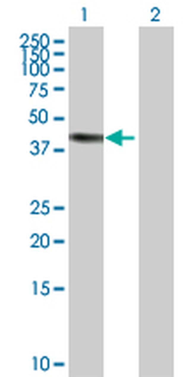 ERCC8 Antibody in Western Blot (WB)