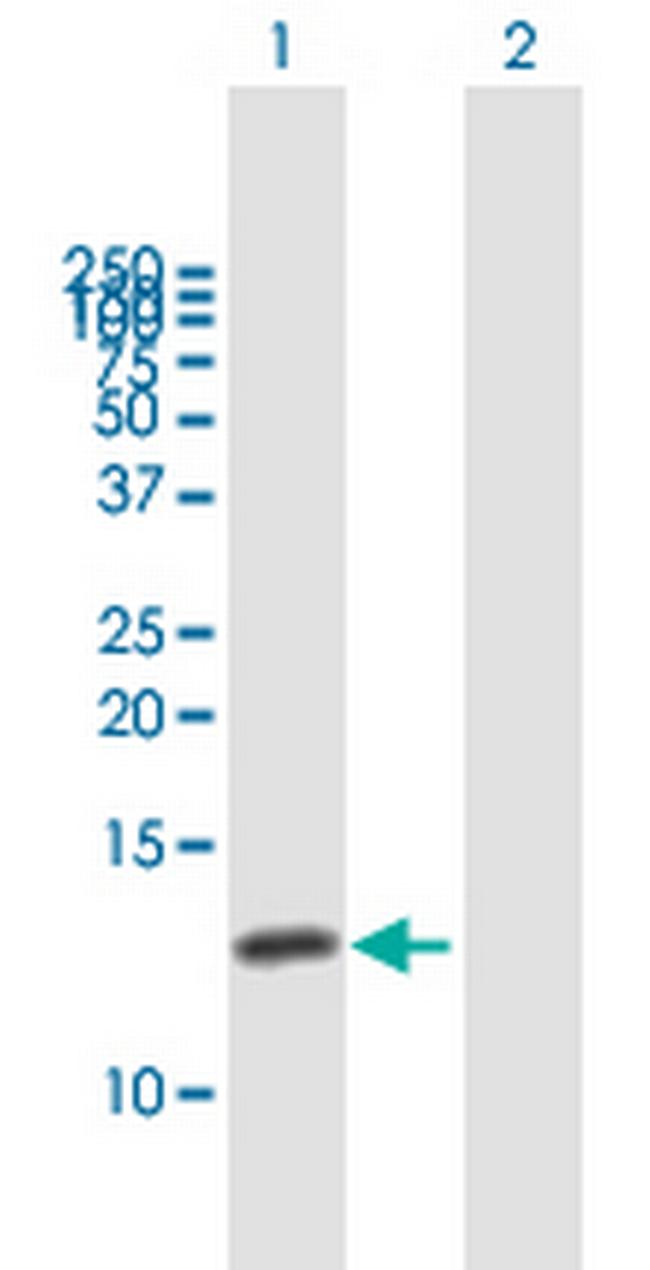 CKS1B Antibody in Western Blot (WB)