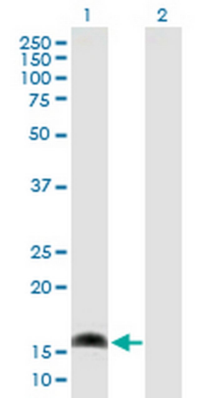 AP1S1 Antibody in Western Blot (WB)