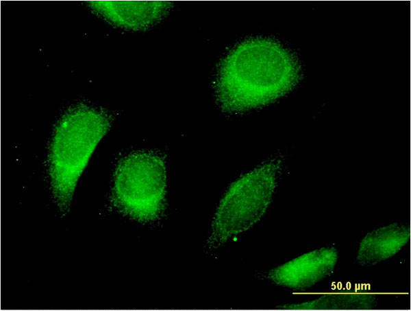 CLCN6 Antibody in Immunocytochemistry (ICC/IF)