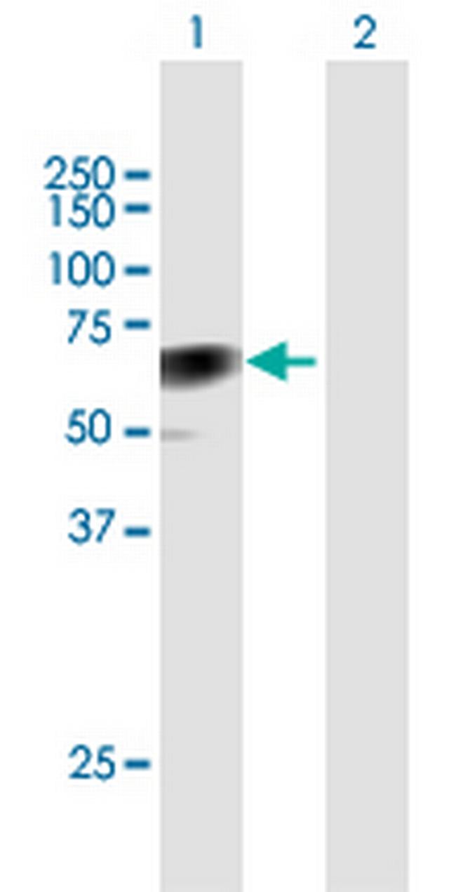 CLU Antibody in Western Blot (WB)
