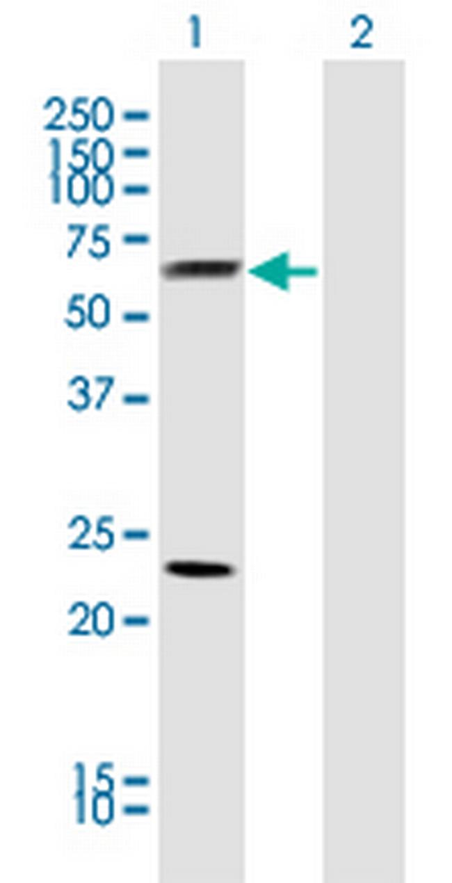 CLU Antibody in Western Blot (WB)
