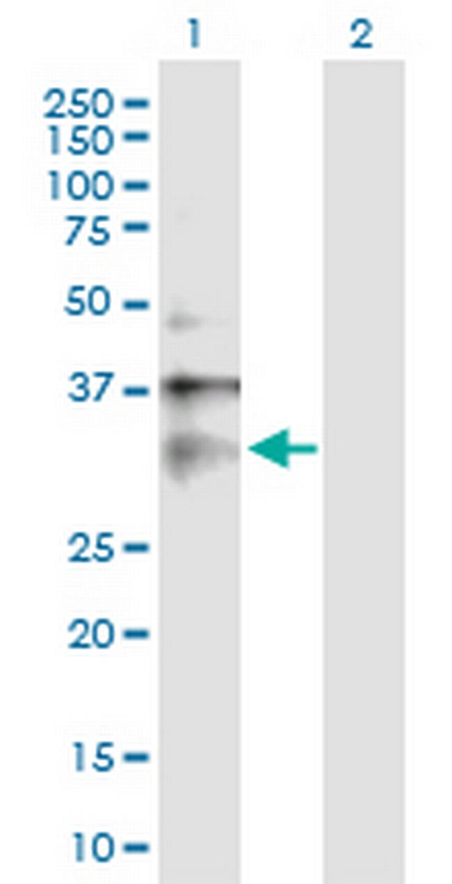 CLIC1 Antibody in Western Blot (WB)