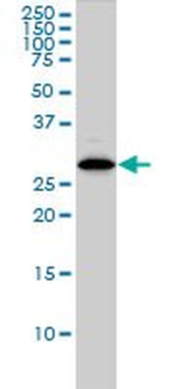 CLIC1 Antibody in Western Blot (WB)