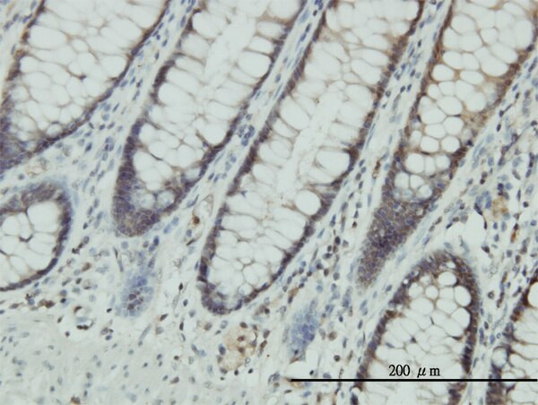 CLIC1 Antibody in Immunohistochemistry (Paraffin) (IHC (P))