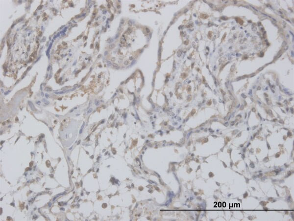 CLIC1 Antibody in Immunohistochemistry (Paraffin) (IHC (P))