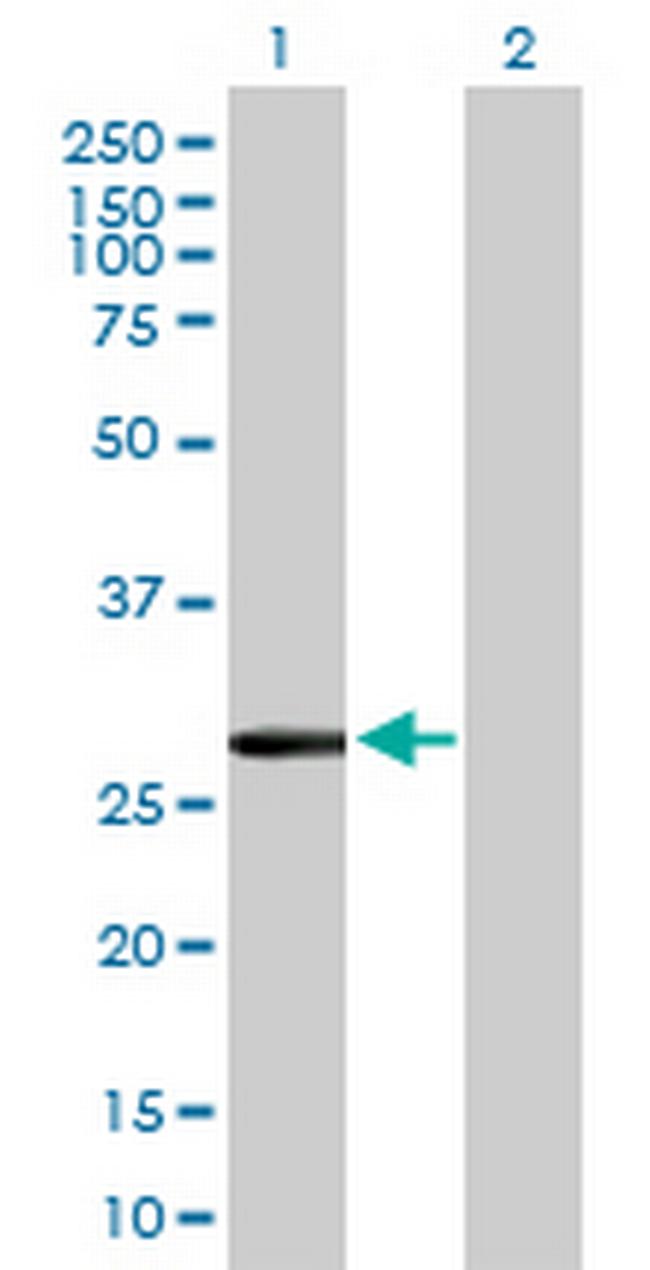 CLIC2 Antibody in Western Blot (WB)