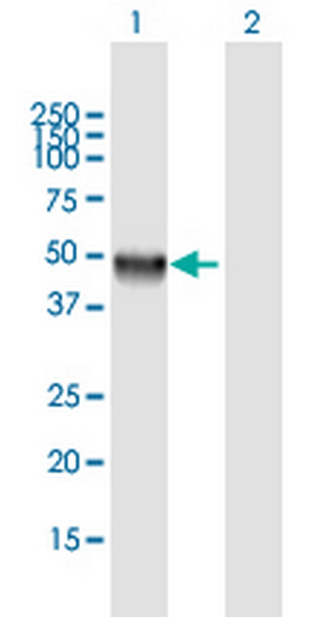 CLN5 Antibody in Western Blot (WB)