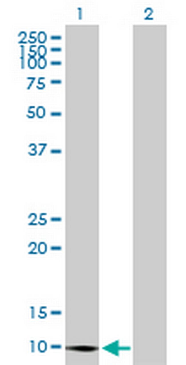 CLPS Antibody in Western Blot (WB)
