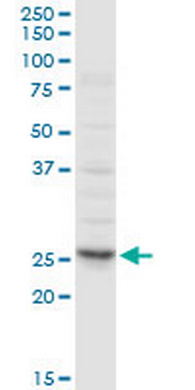 CLTA Antibody in Western Blot (WB)