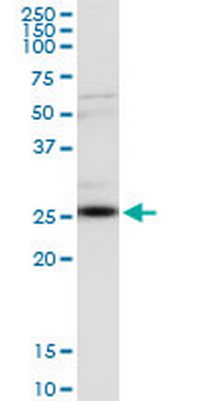 CLTA Antibody in Western Blot (WB)