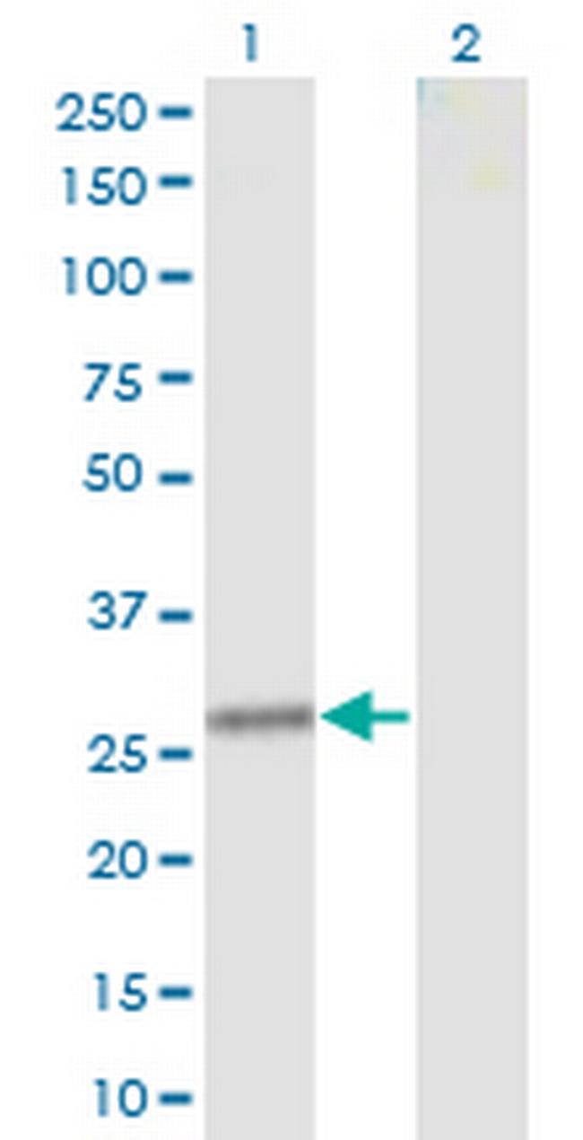 CLTA Antibody in Western Blot (WB)