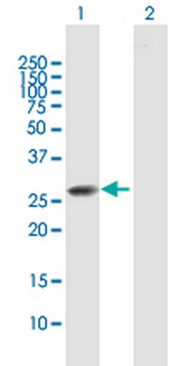 CLTB Antibody in Western Blot (WB)