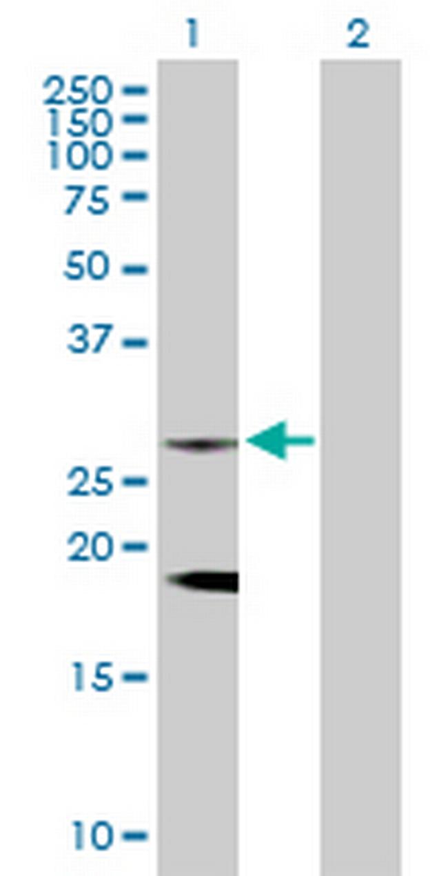 CLTB Antibody in Western Blot (WB)