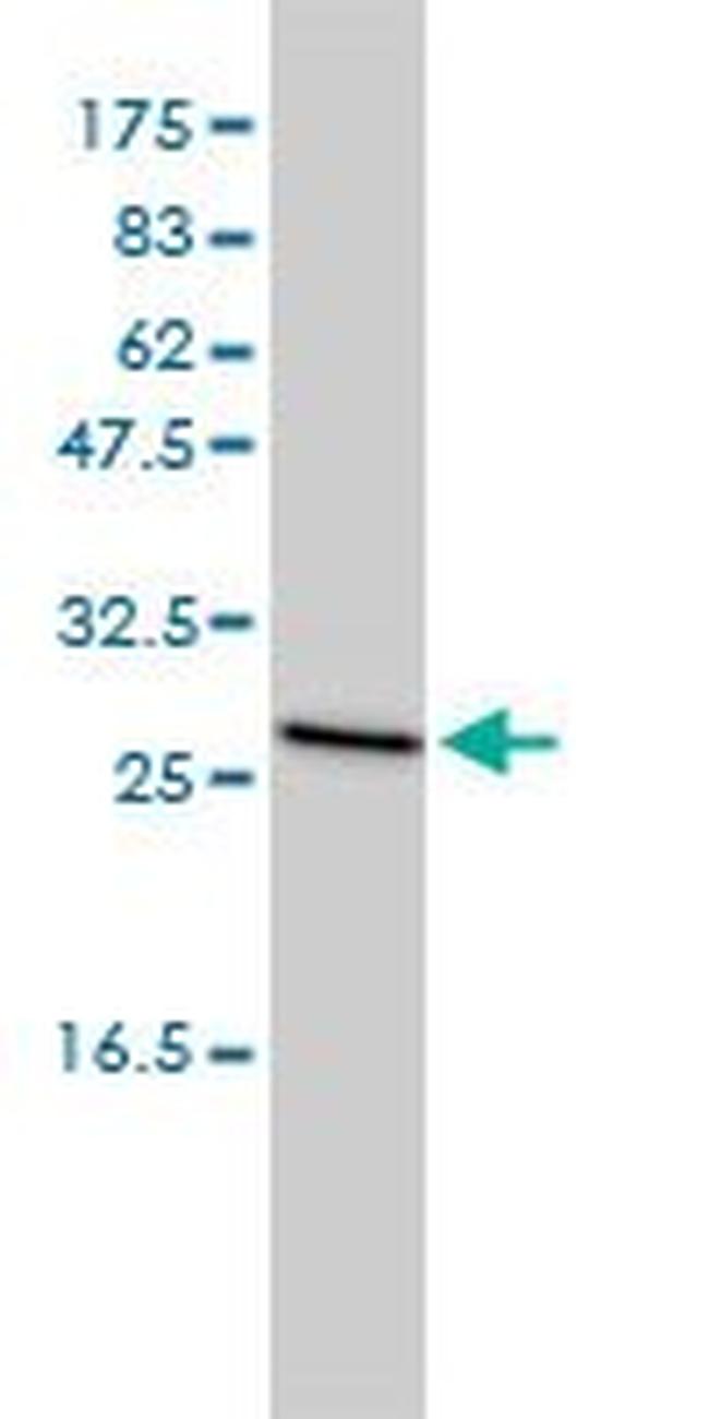 CLTB Antibody in Western Blot (WB)