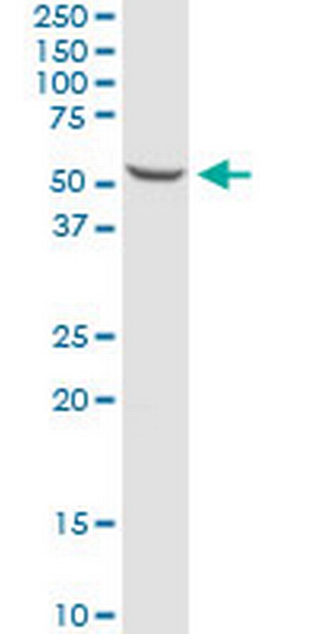 CCR5 Antibody in Western Blot (WB)