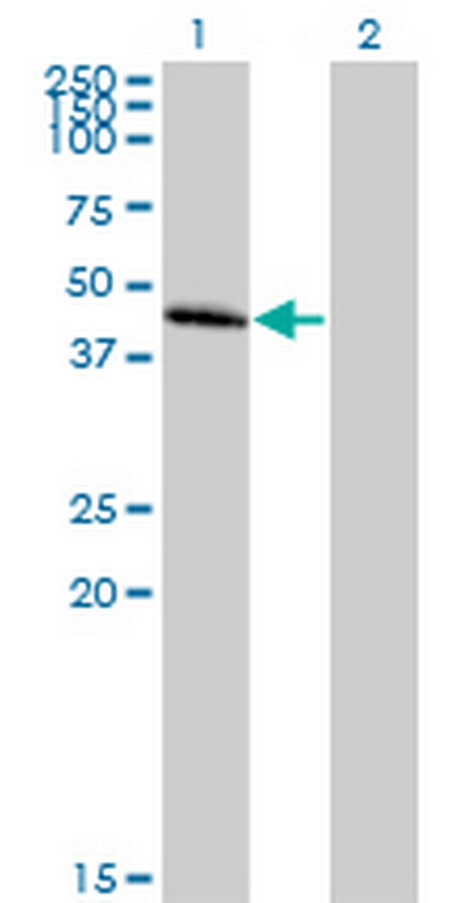 CCBP2 Antibody in Western Blot (WB)