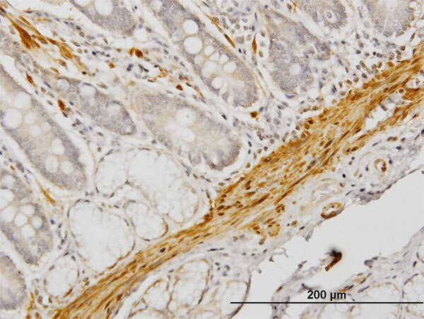 CNN1 Antibody in Immunohistochemistry (Paraffin) (IHC (P))