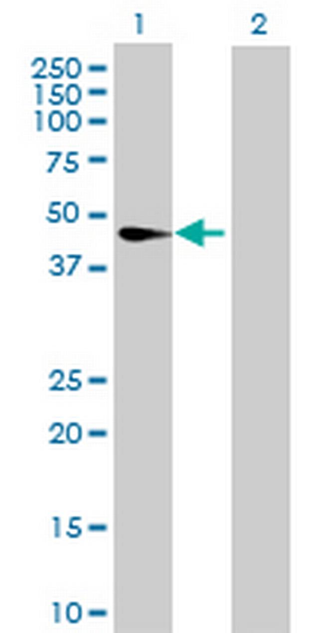 CNP Antibody in Western Blot (WB)